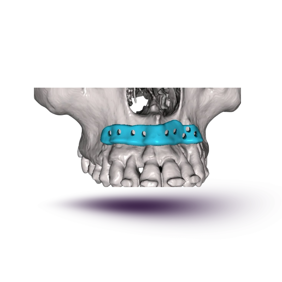 Biovolume