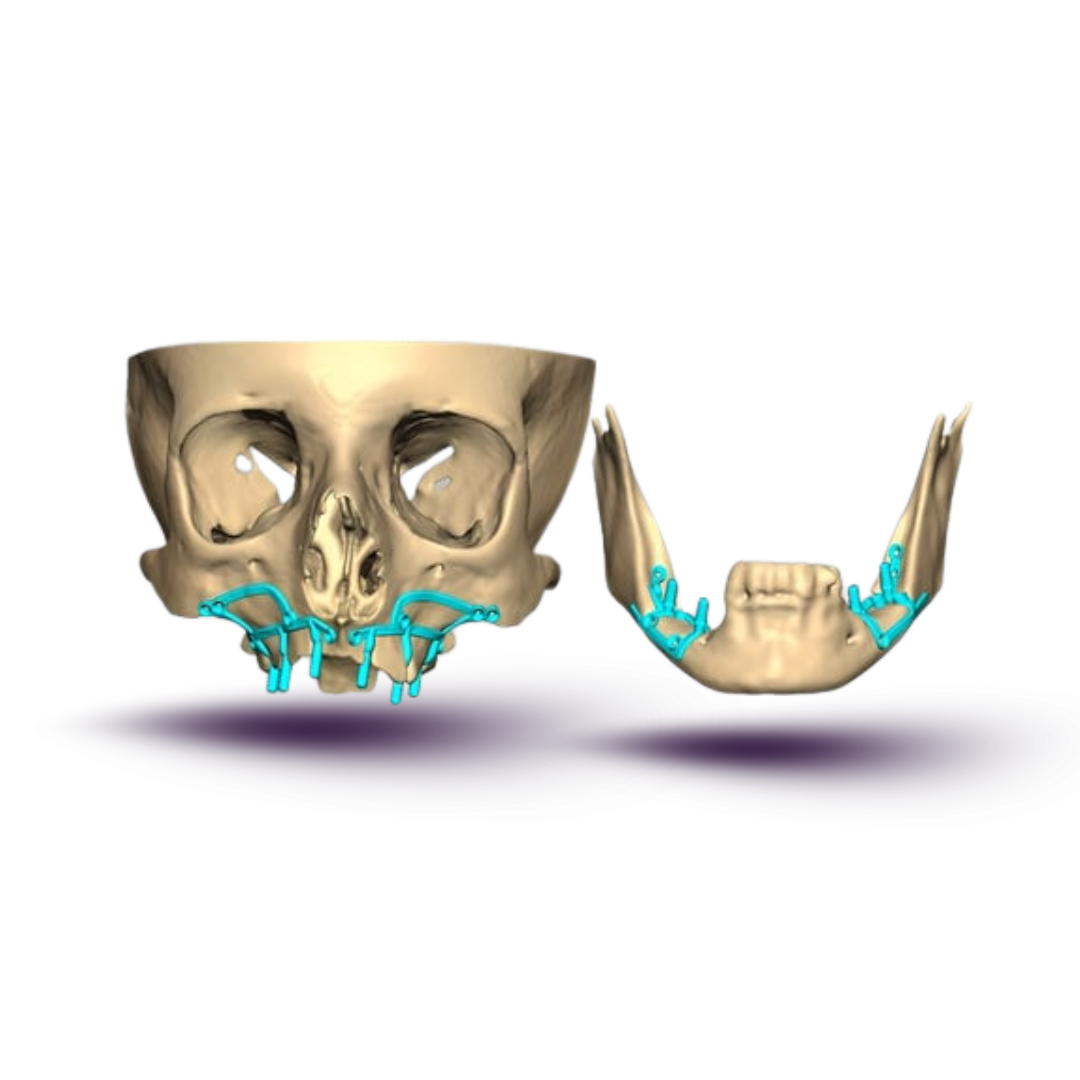 Subperioetal