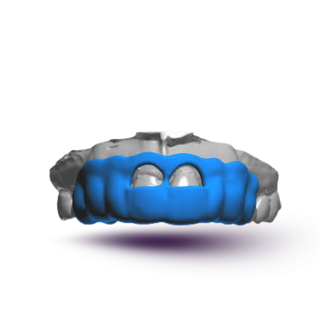 crown Lengthening