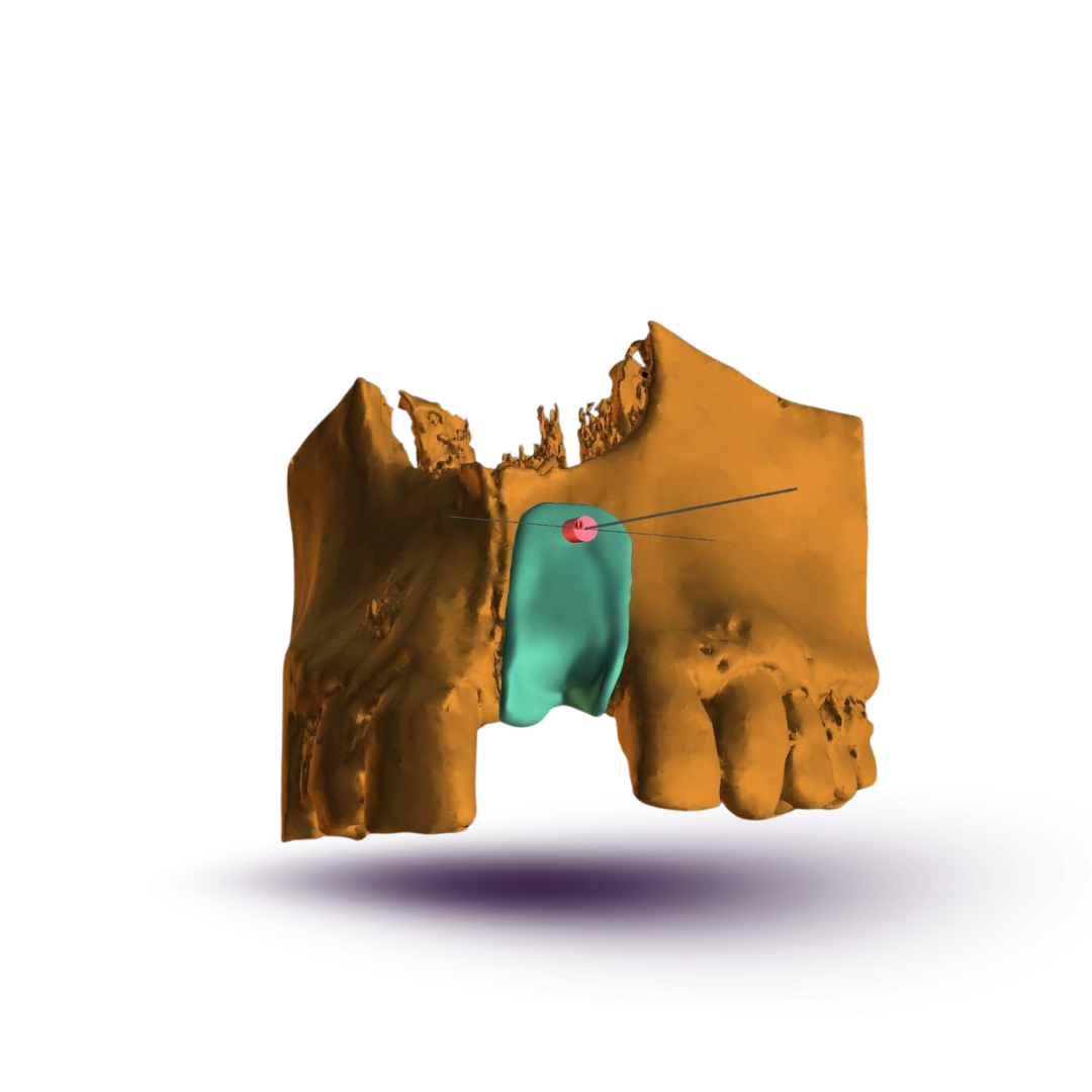 customized membrane