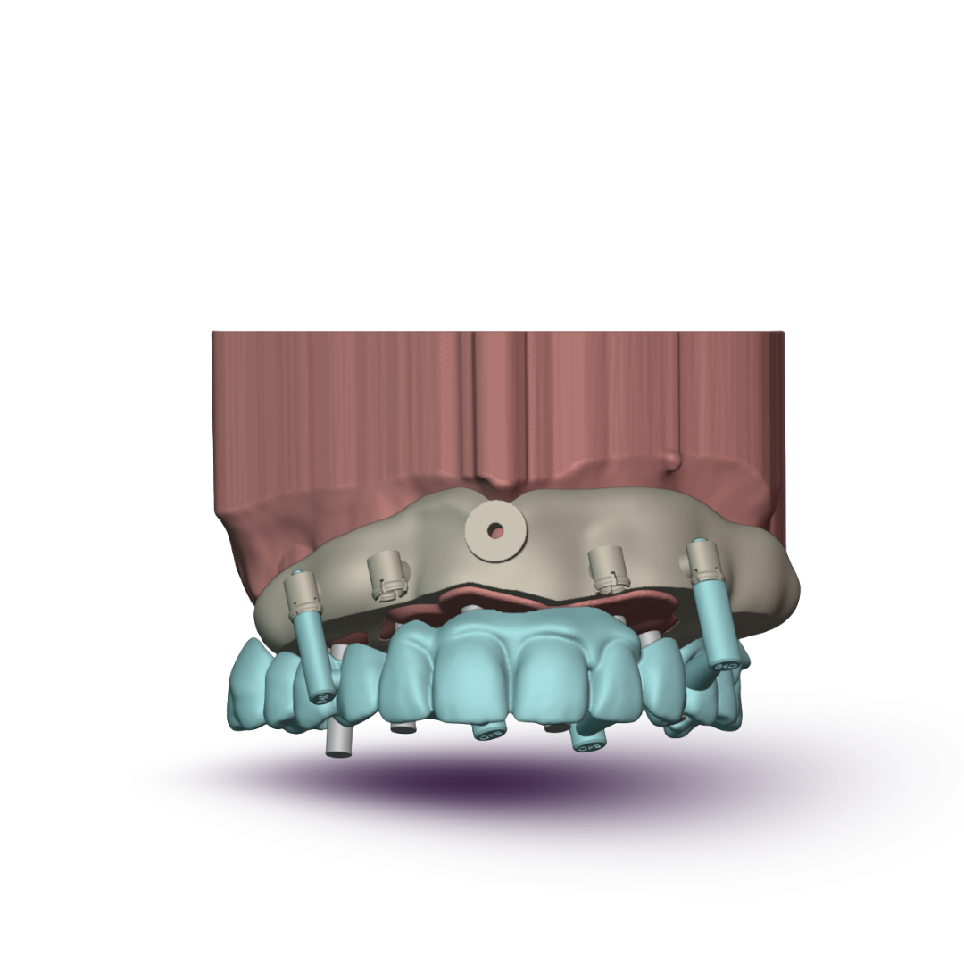 stackable guide