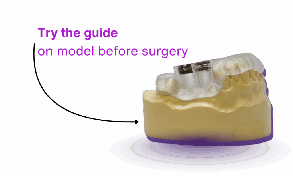Try the implant surgical guide on model first